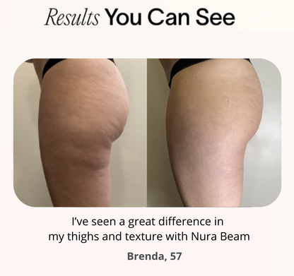 NuraSculpt™ Thigh Band