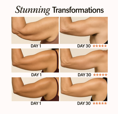 NuraSculpt™ Arm Band