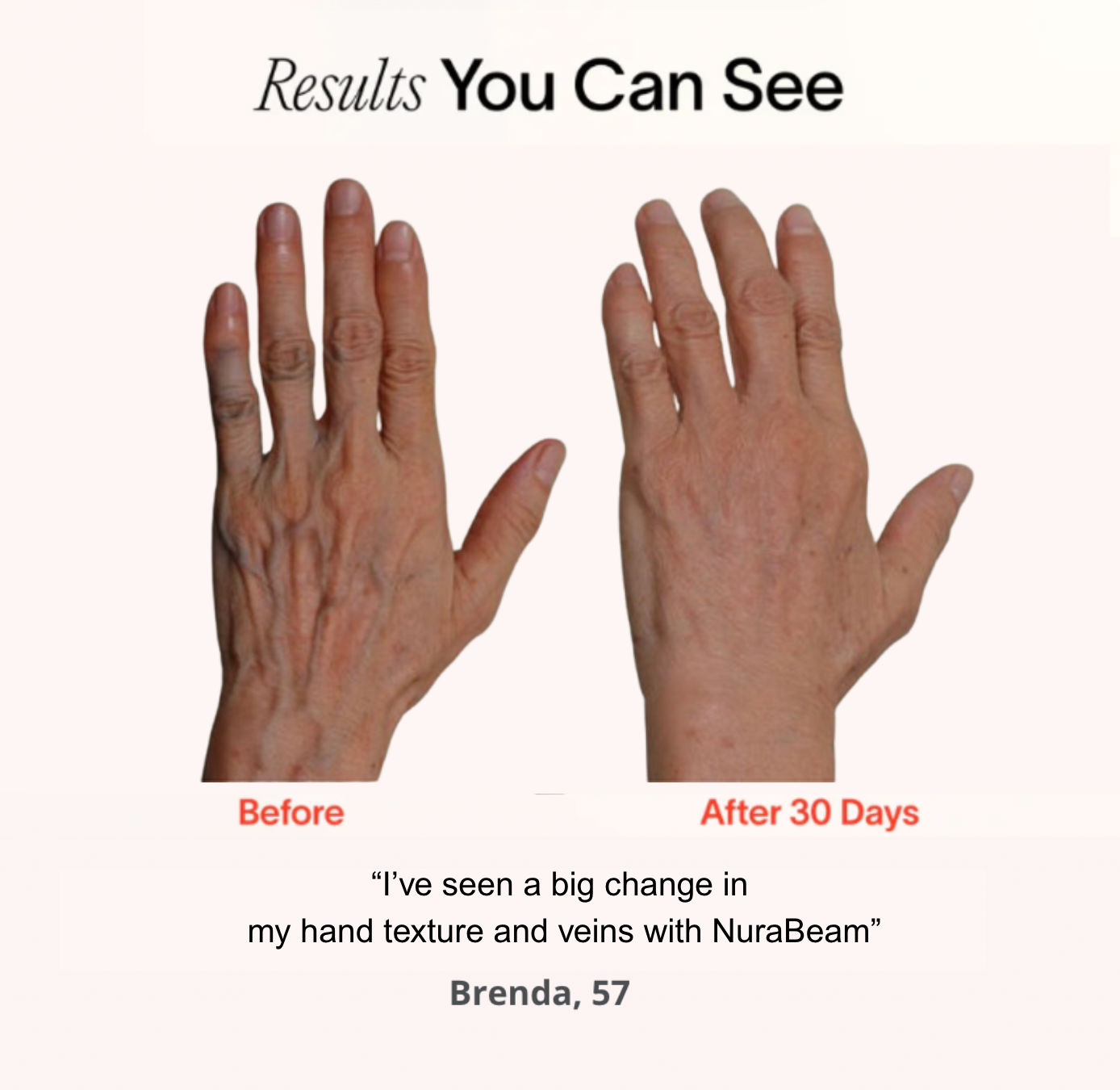 NuraRenewal™ Hand Glove