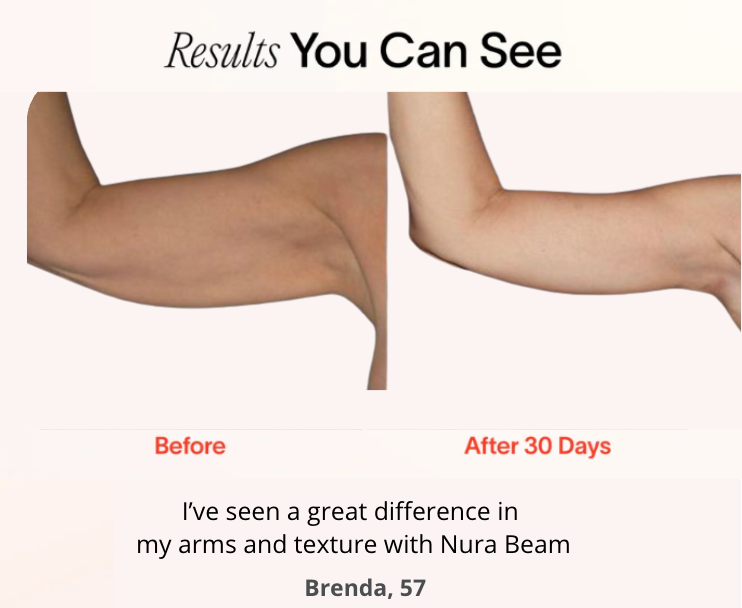 NuraSculpt™ Arm Band